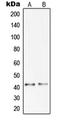 Progastricsin antibody, LS-C352655, Lifespan Biosciences, Western Blot image 