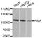 Histone Cell Cycle Regulator antibody, STJ110759, St John