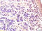 Protein Kinase AMP-Activated Non-Catalytic Subunit Gamma 3 antibody, GTX51582, GeneTex, Immunohistochemistry paraffin image 