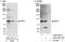 BRCA1 Associated Protein 1 antibody, A302-243A, Bethyl Labs, Immunoprecipitation image 