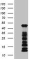 Lysine Methyltransferase 5A antibody, TA808272, Origene, Western Blot image 