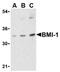 COMM Domain Containing 3 antibody, AP05603PU-N, Origene, Western Blot image 