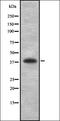 HLA class I histocompatibility antigen, B-81 alpha chain antibody, orb336953, Biorbyt, Western Blot image 