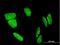 FLJ23834 antibody, H00222256-M03, Novus Biologicals, Immunofluorescence image 