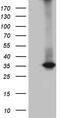 RWD Domain Containing 3 antibody, M08744, Boster Biological Technology, Western Blot image 