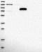 Zinc Finger Protein 180 antibody, NBP1-92613, Novus Biologicals, Western Blot image 