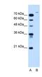 Ubiquitin Specific Peptidase 48 antibody, NBP1-59752, Novus Biologicals, Western Blot image 