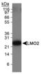 Lysyl Oxidase antibody, MA1-46422, Invitrogen Antibodies, Western Blot image 