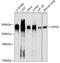 Ubiquitin Specific Peptidase 24 antibody, GTX64858, GeneTex, Western Blot image 