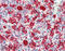 Heme Oxygenase 1 antibody, ADI-SPA-896-J, Enzo Life Sciences, Immunohistochemistry paraffin image 