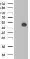 NADH:Ubiquinone Oxidoreductase Complex Assembly Factor 7 antibody, M12013, Boster Biological Technology, Western Blot image 