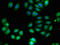 Uncharacterized aarF domain-containing protein kinase 4 antibody, orb51882, Biorbyt, Immunocytochemistry image 