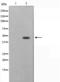 Zinc Finger Protein 174 antibody, orb225349, Biorbyt, Western Blot image 