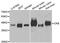 Creatine Kinase B antibody, STJ23145, St John