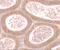 Motile Sperm Domain Containing 1 antibody, A15298, Boster Biological Technology, Immunohistochemistry paraffin image 