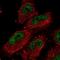 Epithelial Cell Transforming 2 Like antibody, NBP1-90847, Novus Biologicals, Immunofluorescence image 