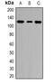 Helicase Like Transcription Factor antibody, abx141474, Abbexa, Western Blot image 