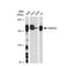 FA Complementation Group D2 antibody, GTX01531, GeneTex, Western Blot image 