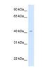 Homeotic protein caudal antibody, NBP1-56308, Novus Biologicals, Western Blot image 