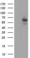 Amylase Alpha 2A (Pancreatic) antibody, LS-C790228, Lifespan Biosciences, Western Blot image 