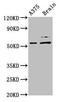 Preferentially Expressed Antigen In Melanoma antibody, LS-C370151, Lifespan Biosciences, Western Blot image 