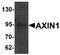 Axin 1 antibody, TA319744, Origene, Western Blot image 