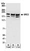 FGR Proto-Oncogene, Src Family Tyrosine Kinase antibody, A300-346A, Bethyl Labs, Western Blot image 