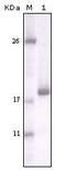 Discoidin Domain Receptor Tyrosine Kinase 2 antibody, MA5-15356, Invitrogen Antibodies, Western Blot image 