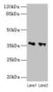 Retinol Dehydrogenase 11 antibody, CSB-PA019523LA01HU, Cusabio, Western Blot image 