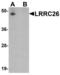 Leucine-rich repeat-containing protein 26 antibody, LS-C201150, Lifespan Biosciences, Western Blot image 