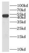 SH2 Domain Containing 2A antibody, FNab07821, FineTest, Western Blot image 