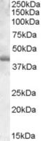 Fibroblast growth factor receptor 2 antibody, 42-748, ProSci, Western Blot image 