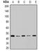 Cytochrome P450 2F1 antibody, orb378021, Biorbyt, Western Blot image 