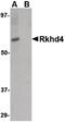 Mex-3 RNA Binding Family Member A antibody, PA5-20639, Invitrogen Antibodies, Western Blot image 