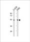 Chromosome transmission fidelity protein 8 homolog antibody, PA5-72323, Invitrogen Antibodies, Western Blot image 