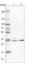 Protein CDV3 antibody, NBP1-81779, Novus Biologicals, Western Blot image 