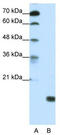 TGFB Induced Factor Homeobox 2 Like Y-Linked antibody, TA341454, Origene, Western Blot image 