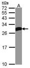 Deoxycytidine kinase antibody, orb73697, Biorbyt, Western Blot image 