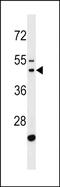 Cytosolic Arginine Sensor For MTORC1 Subunit 2 antibody, PA5-72114, Invitrogen Antibodies, Western Blot image 