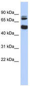 NIM1 Serine/Threonine Protein Kinase antibody, TA337835, Origene, Western Blot image 