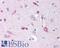 NPC Intracellular Cholesterol Transporter 1 antibody, LS-B509, Lifespan Biosciences, Immunohistochemistry frozen image 