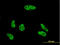 Vacuolar Protein Sorting 72 Homolog antibody, LS-C198315, Lifespan Biosciences, Immunofluorescence image 