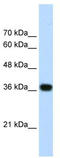 DFS70 antibody, TA338014, Origene, Western Blot image 