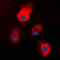 S100 Calcium Binding Protein A1 antibody, LS-B16868, Lifespan Biosciences, Immunofluorescence image 