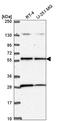 Serine/Threonine Kinase 11 antibody, HPA067481, Atlas Antibodies, Western Blot image 