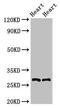 Myogenic factor 5 antibody, orb401196, Biorbyt, Western Blot image 