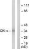 Casein Kinase 1 Alpha 1 antibody, TA313698, Origene, Western Blot image 