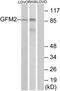 G Elongation Factor Mitochondrial 2 antibody, TA315912, Origene, Western Blot image 