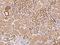 Hepatocyte Growth Factor antibody, 10463-RI85, Sino Biological, Immunohistochemistry paraffin image 