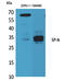 Surfactant Protein A2 antibody, GTX34193, GeneTex, Western Blot image 